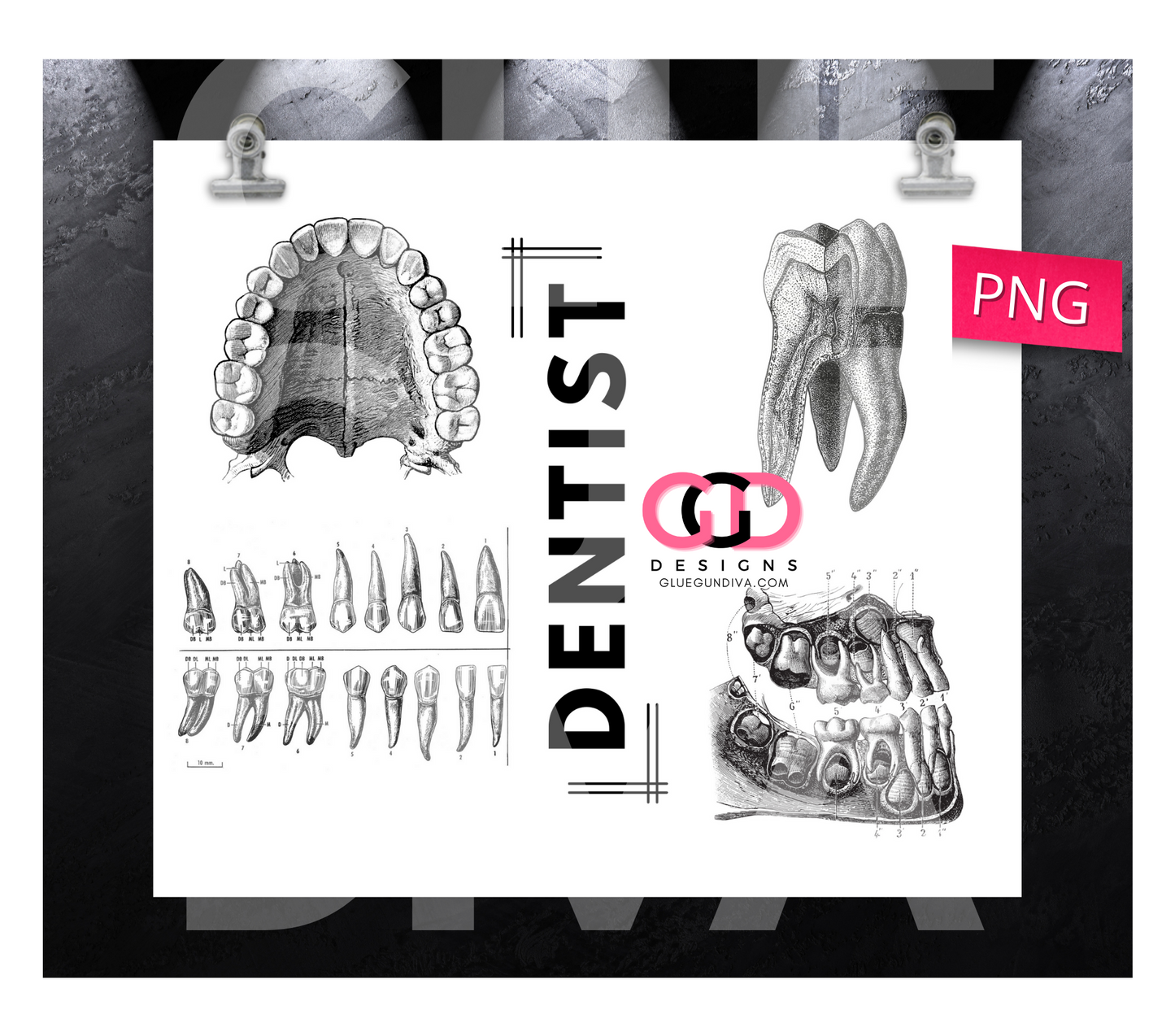 Dentist- Digital tumbler wrap for 20 oz skinny straight tumbler