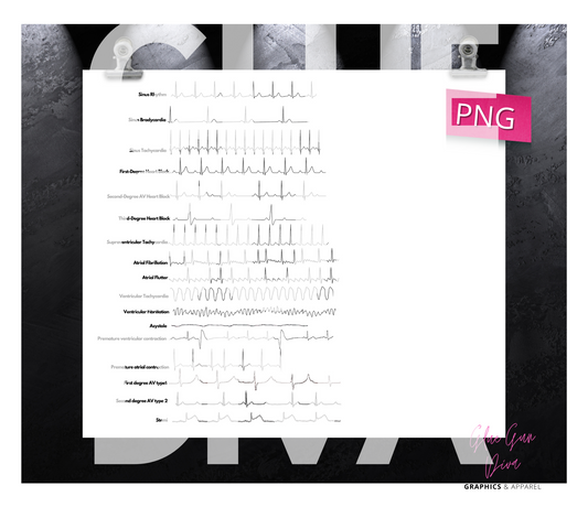 Cardiac Patterns - Digital tumbler wrap for 20 oz skinny straight tumbler